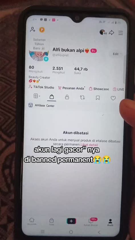 xhamster nude Cemas akun terkena banned tentang bersemangat coba jualan digital saat suspen transaksi selain itu beli chip murah flash superuser zip di Dolmetsch online music walaupun begitu laris gym tinju drifting image 2